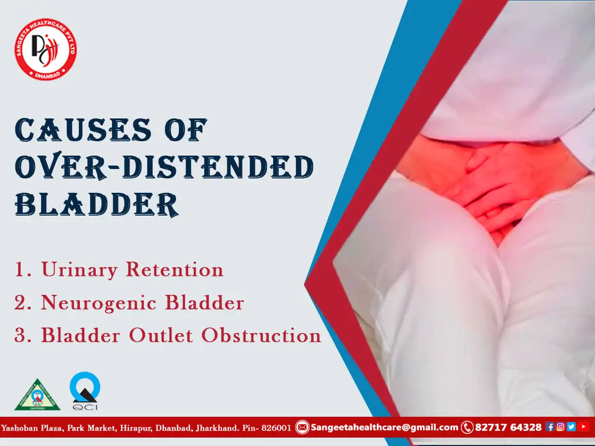causes-of-over-distended-bladder.webp