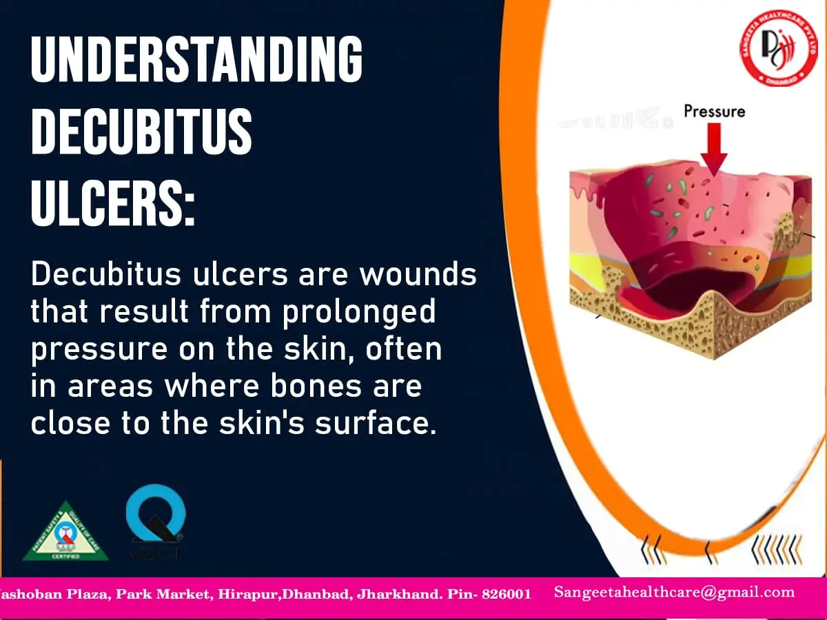 Understanding Decubitus Ulcers