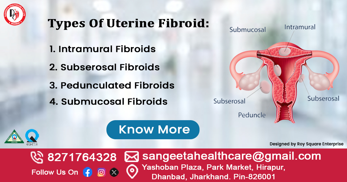 Uterine Fibroids