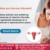 Uterine Fibroids